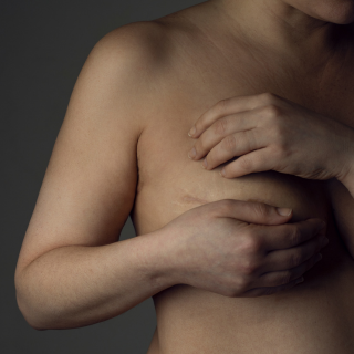 2025 EMH Multidisciplinary Breast Tumor Board (RSS) Banner